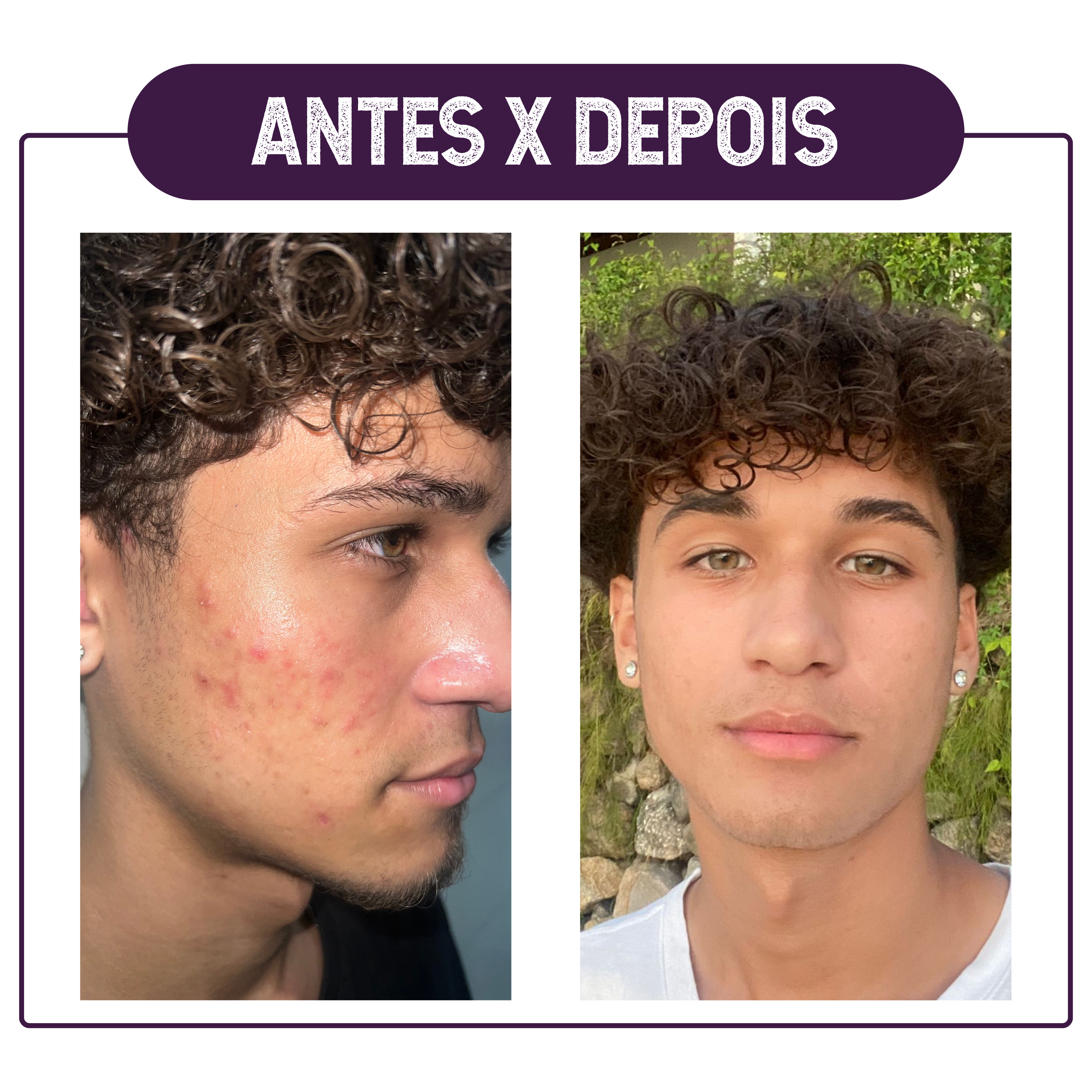 ANTES X DEPOIS