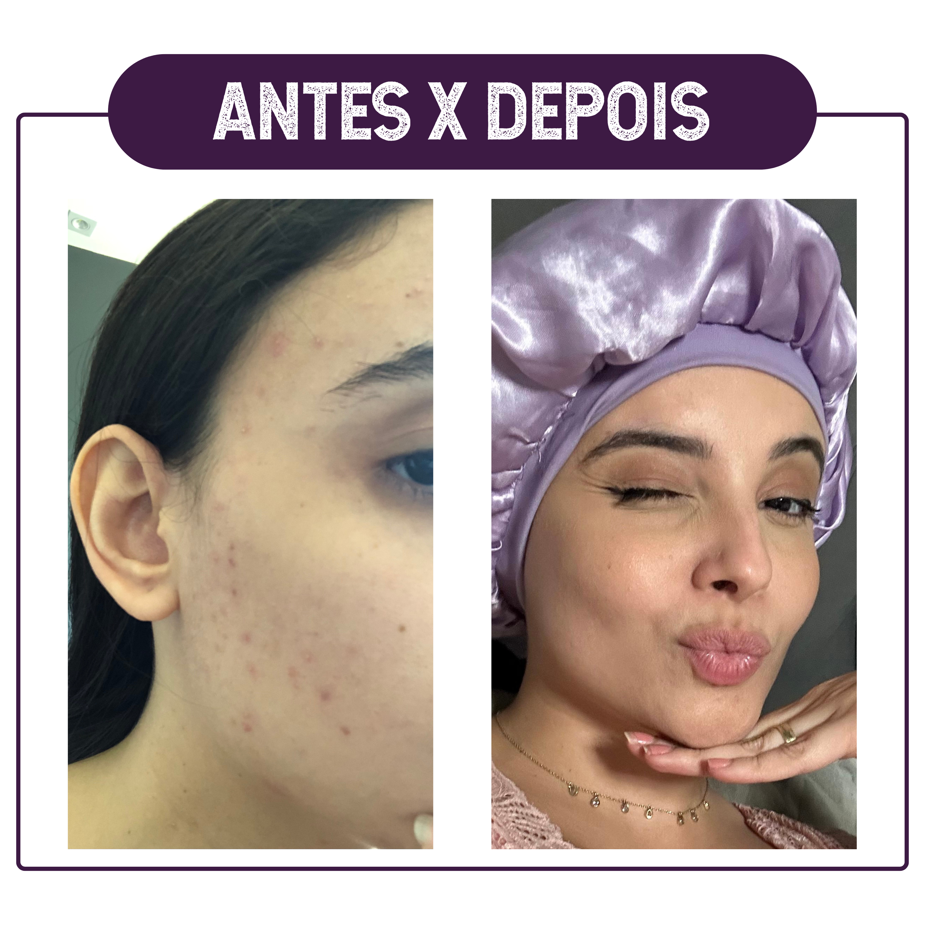 ANTES X DEPOIS2