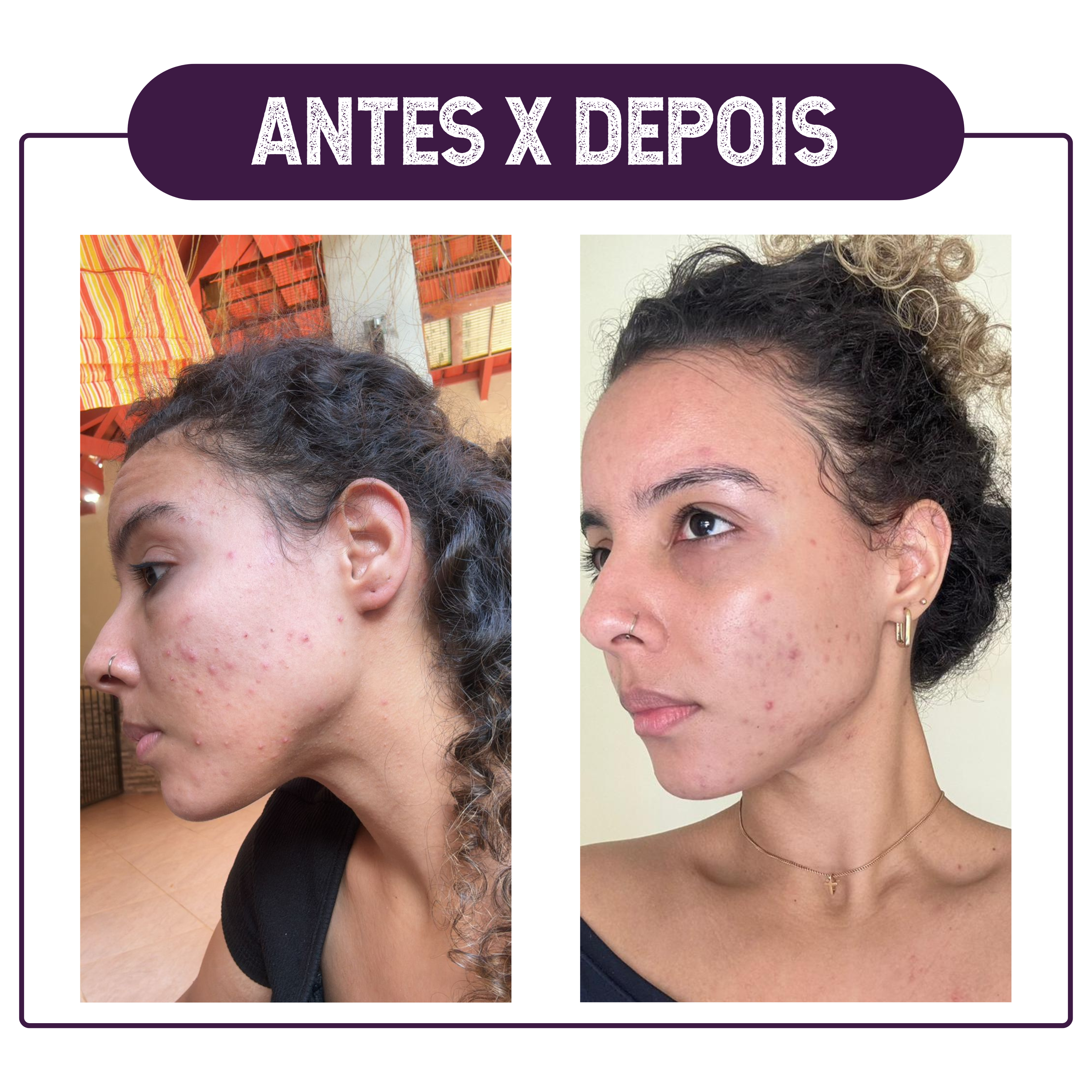 ANTES X DEPOIS3