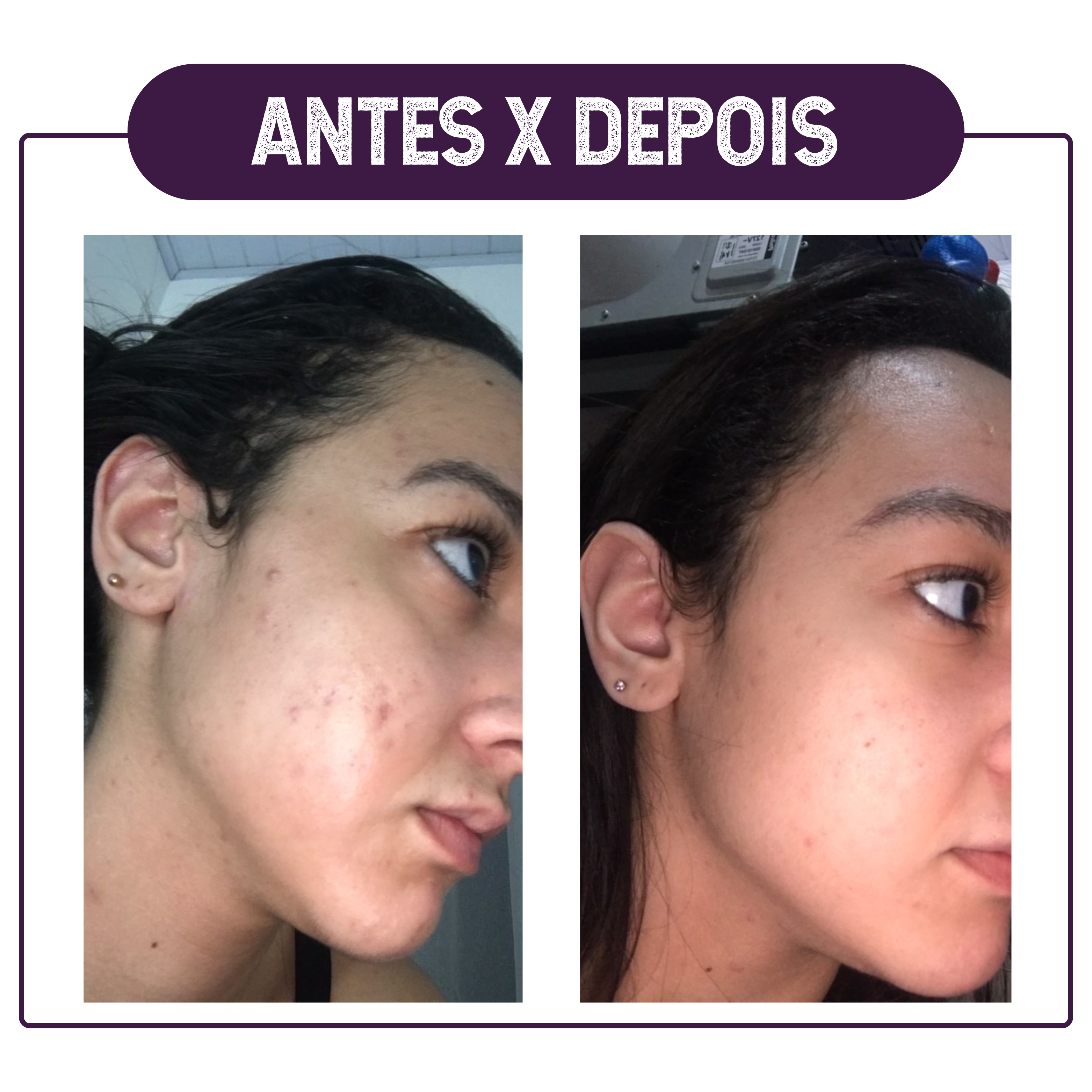 ANTES X DEPOIS6