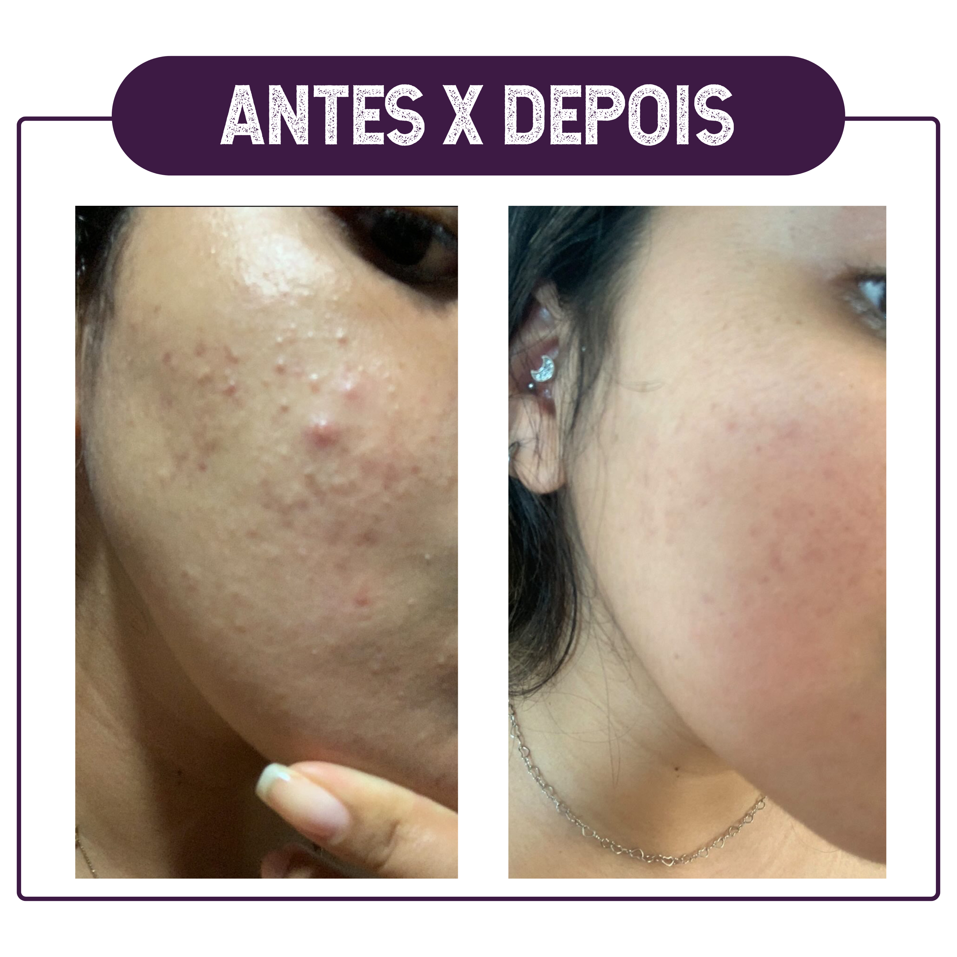 ANTES X DEPOIS7