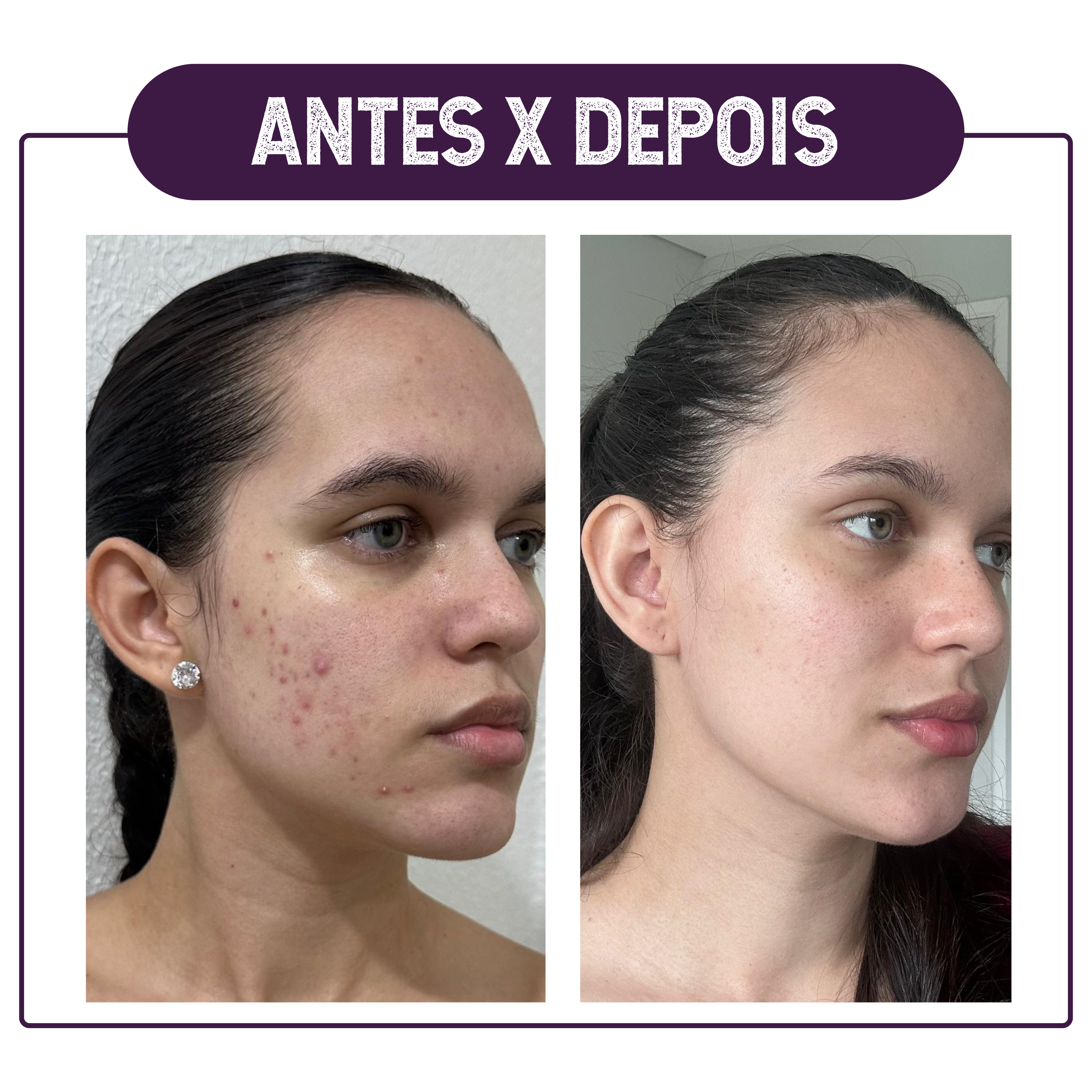 ANTES X DEPOIS8